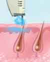 dcd1